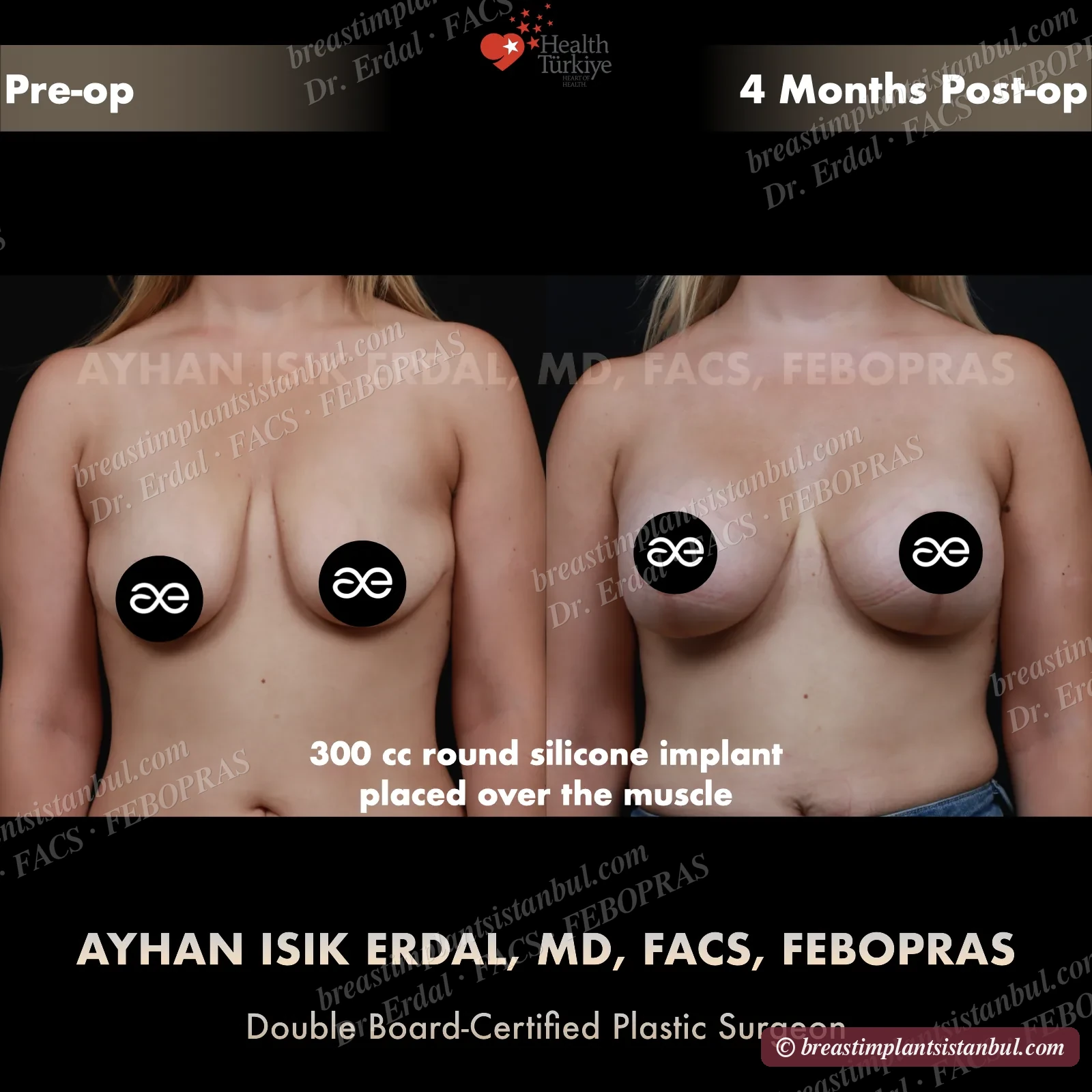 Case 2 — frontal view