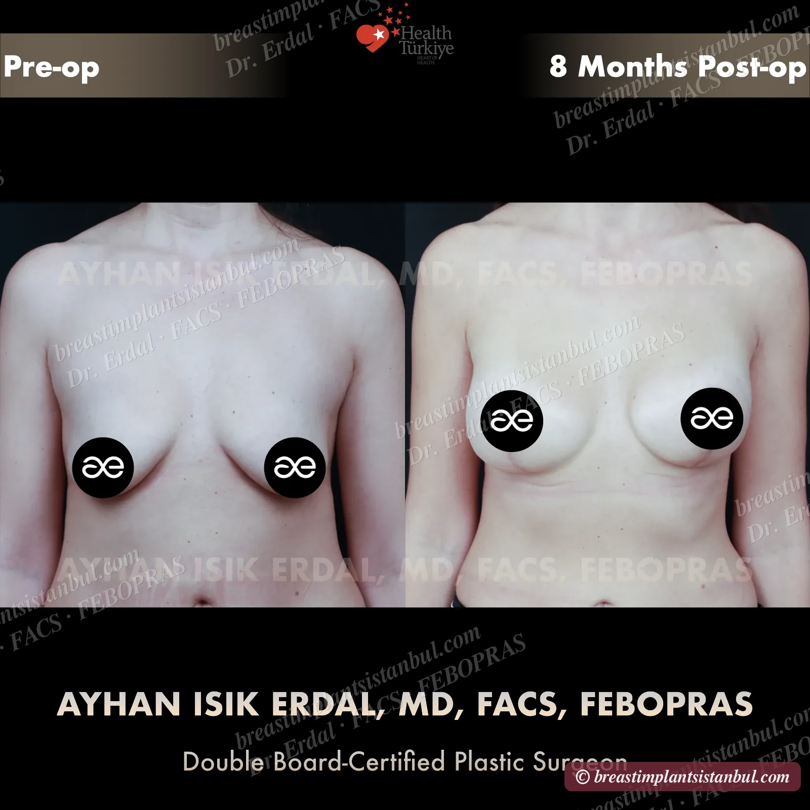 Case 3 — frontal view