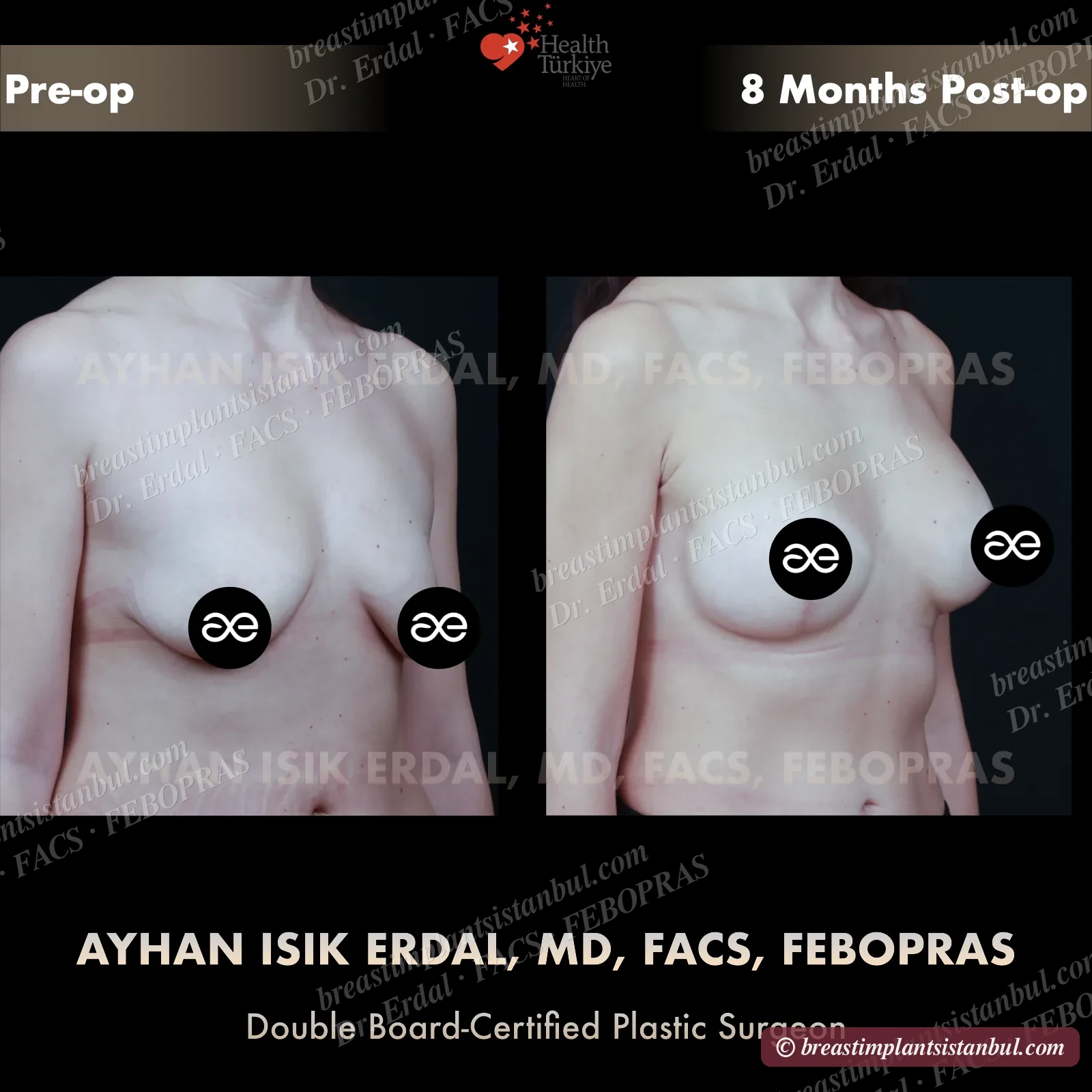 Case 3 — oblique view