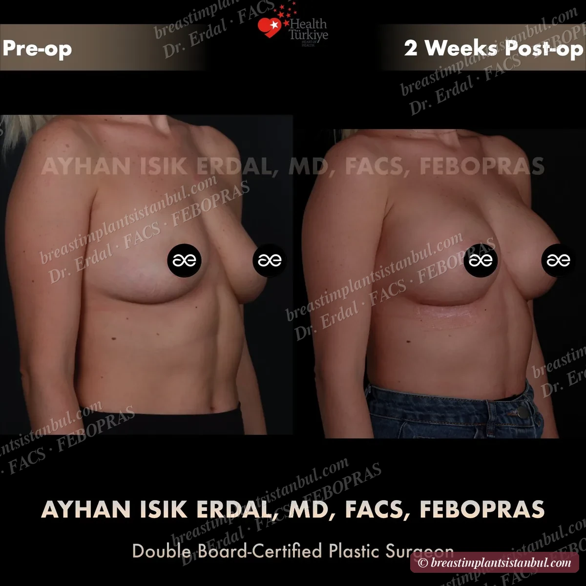 Case 1 — oblique view