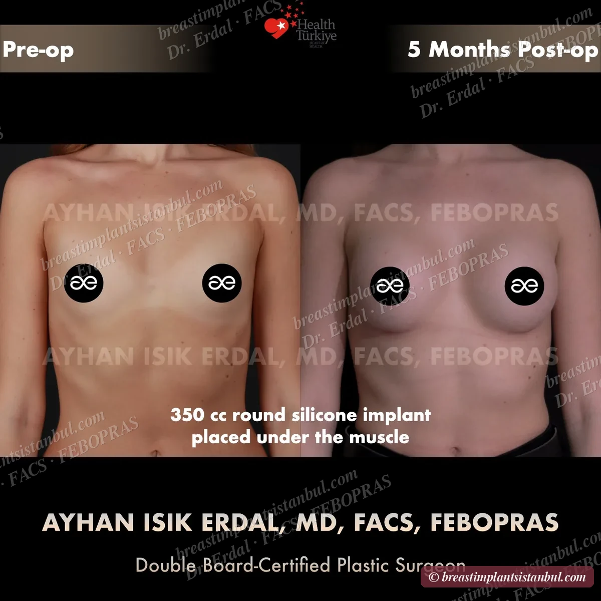 Case 2 — frontal view