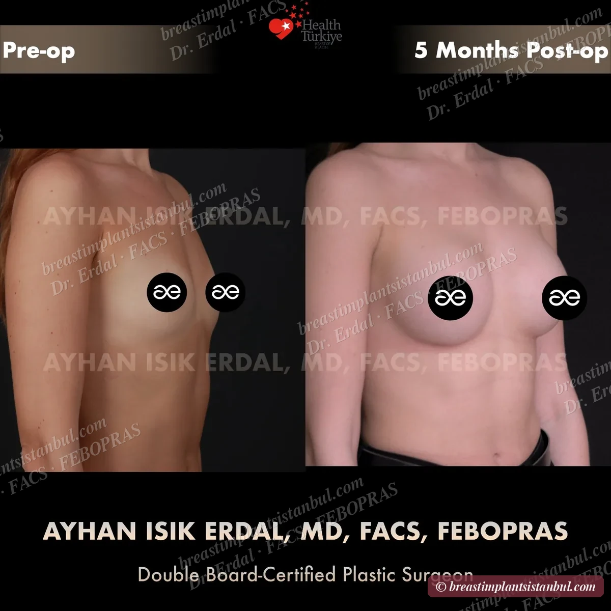 Case 2 — oblique view