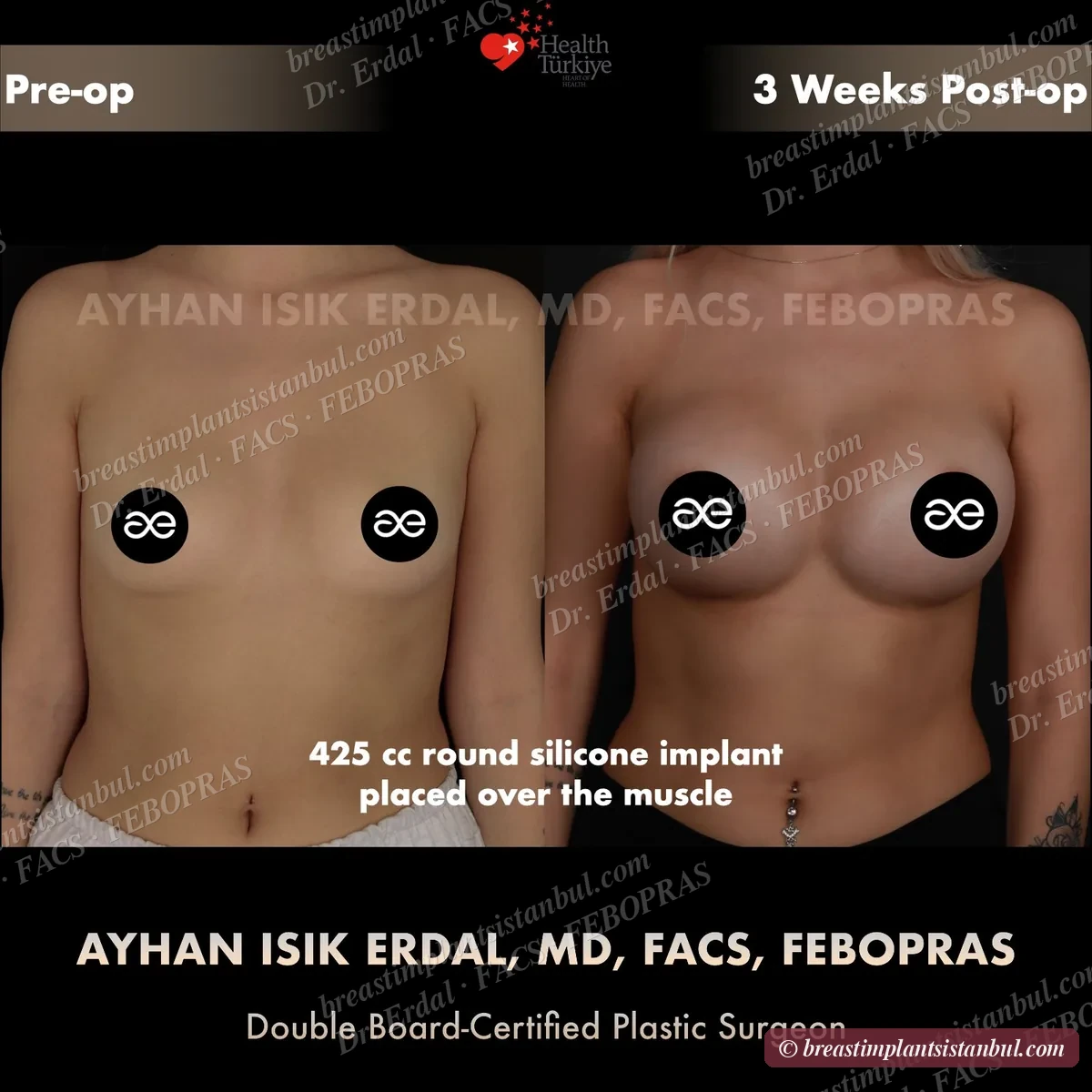 Case 3 — frontal view