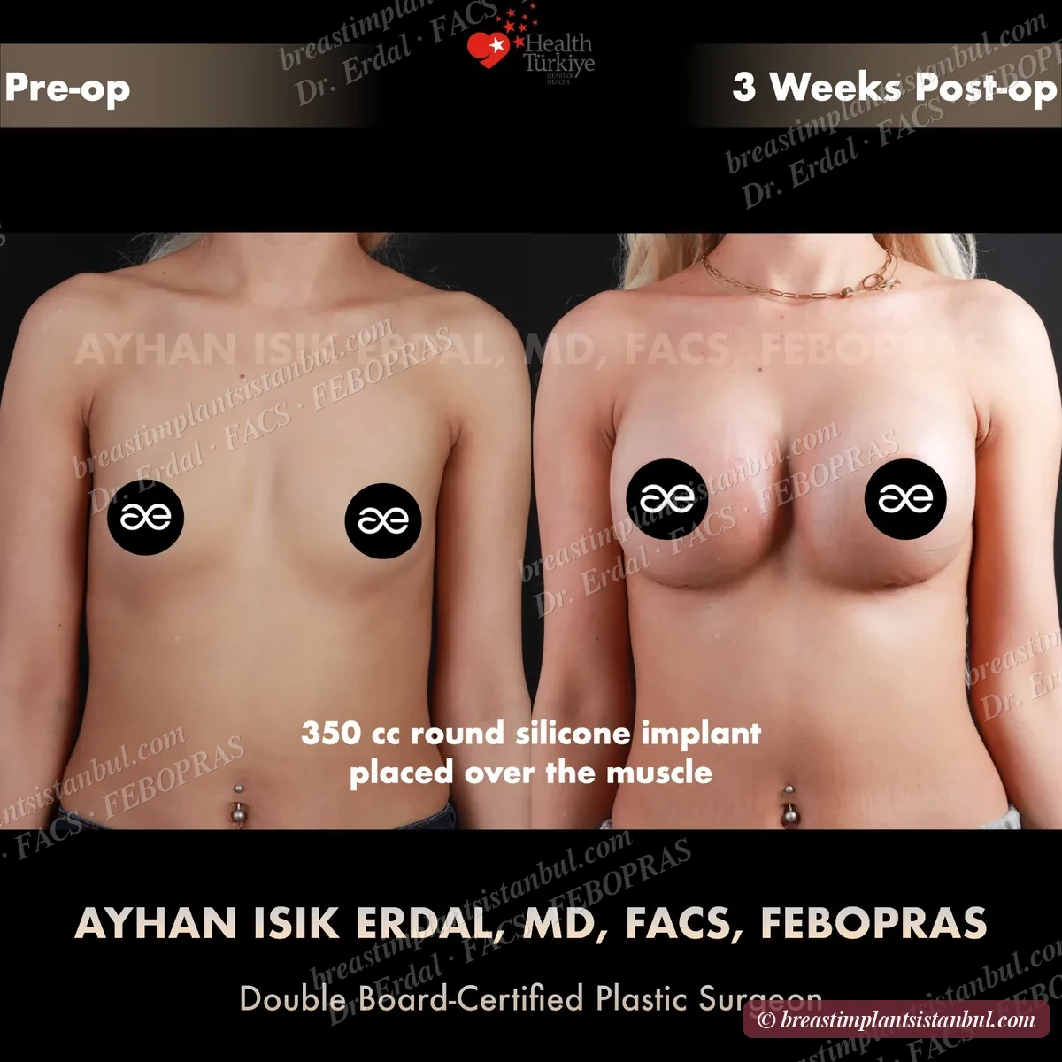 Case 4 — frontal view