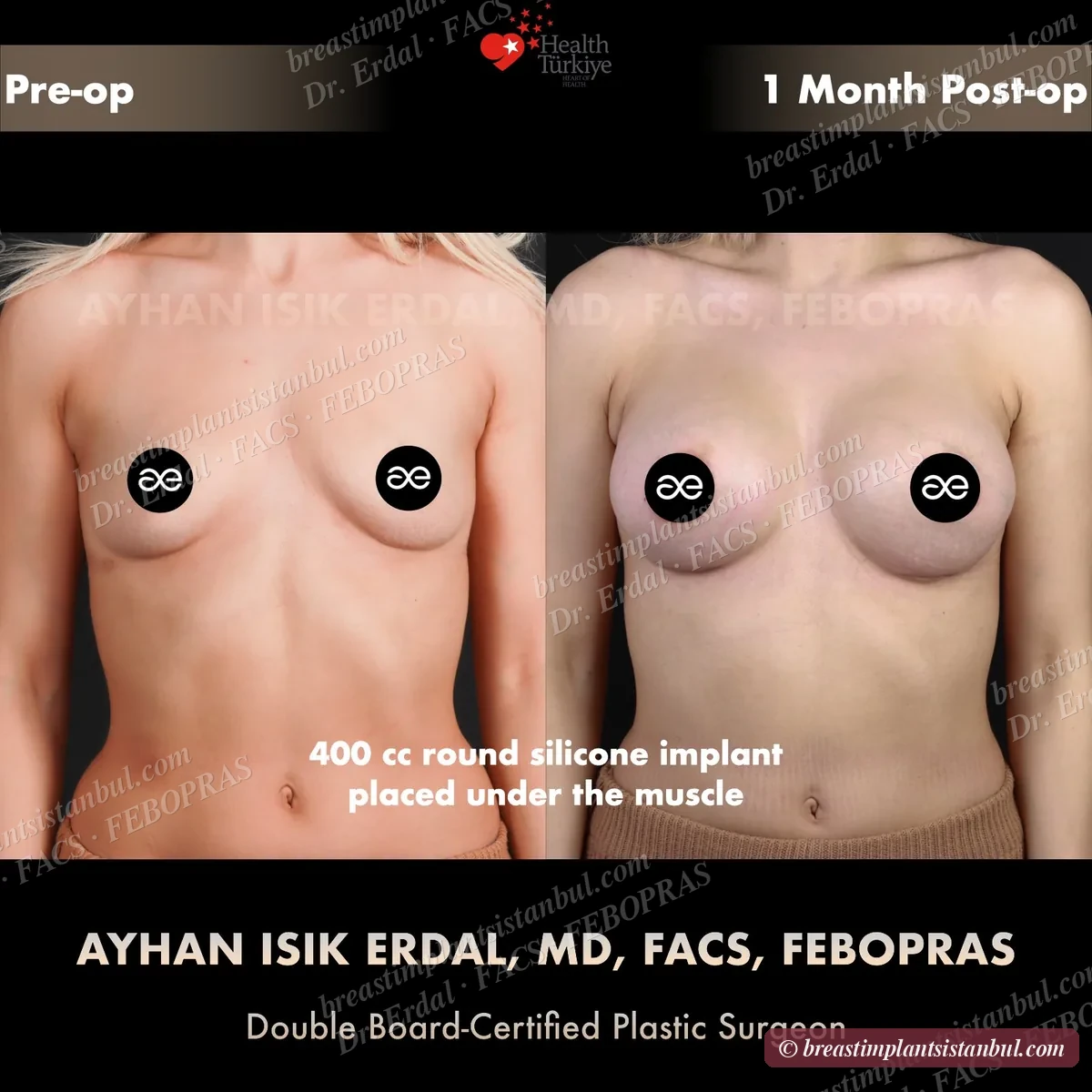 Case 5 — frontal view