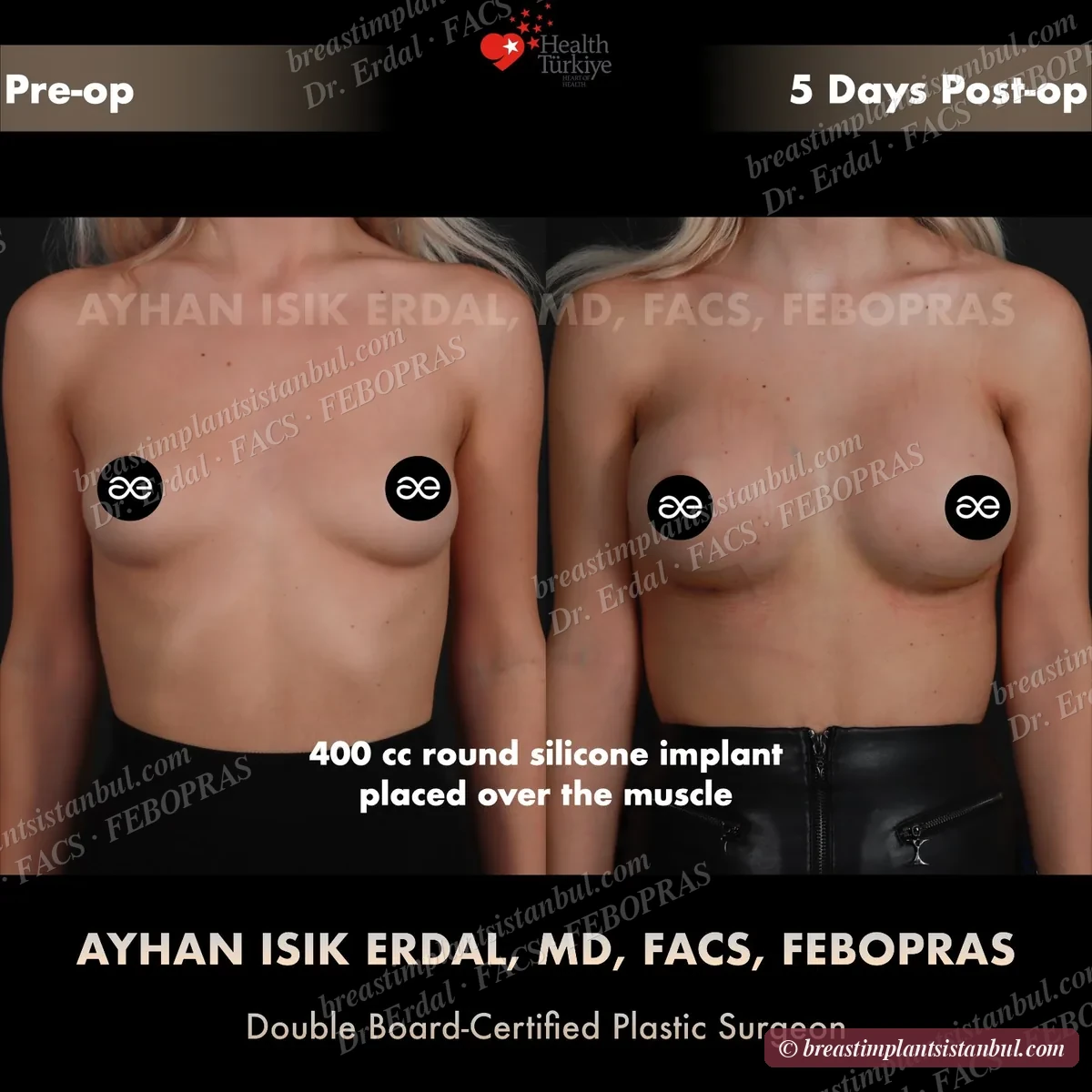 Case 6 — frontal view