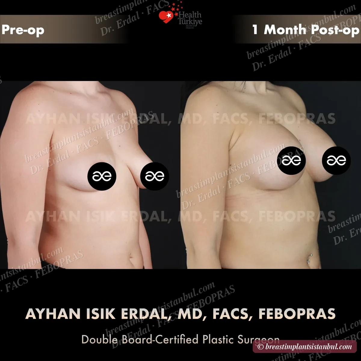 Case 7 — oblique view