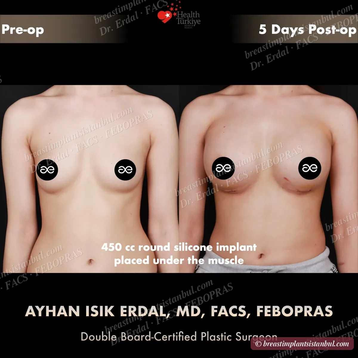 Case 8 — frontal view