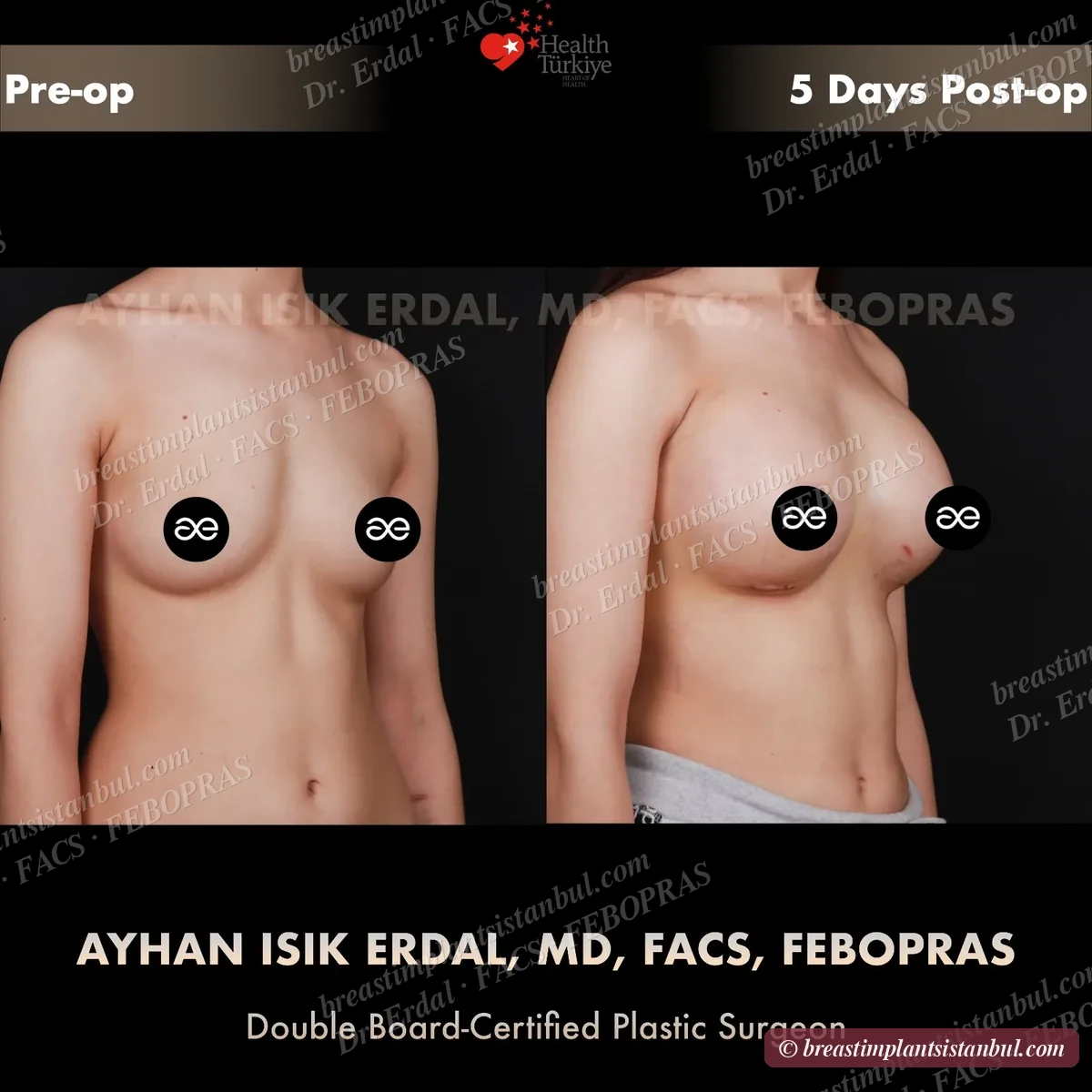 Case 8 — oblique view