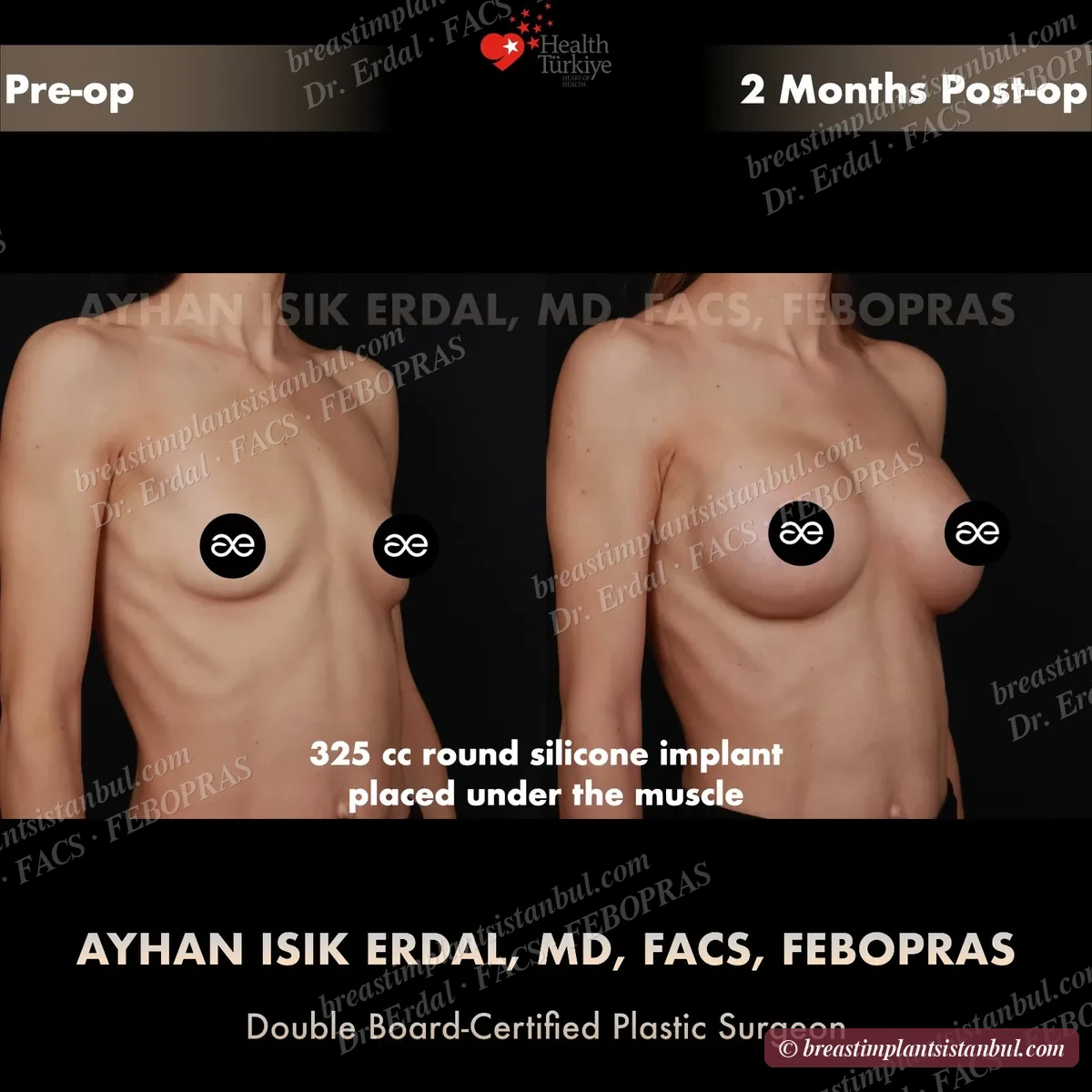 Case 10 — oblique view